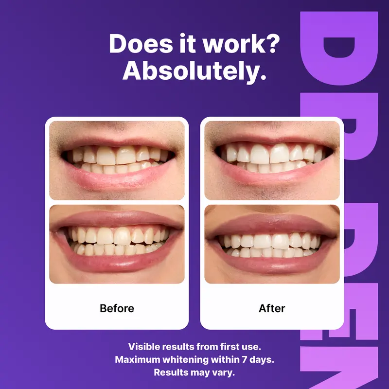 Purple Teeth Whitening Strips