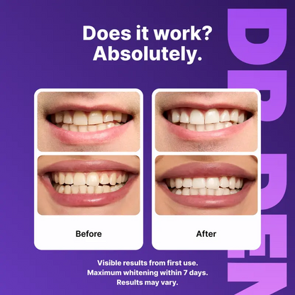 Purple Teeth Whitening Strips